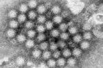 Data CDC: Kasus Norovirus Melonjak di Meberapa Wilayah Amerika Serikat