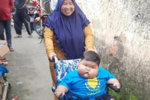 1.440 Balita Terindikasi Obesitas di Kabupaten Bekasi
