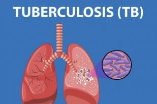 Ciri-ciri Batuk karena TBC