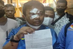 Polisi Tangkap Tiga Pelaku Pengeroyokan Ketua Umum KNPI