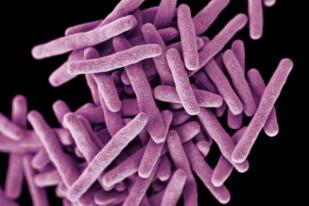 Kemenkes Kembangkan Tiga Vaksin untuk Tuberkulosis
