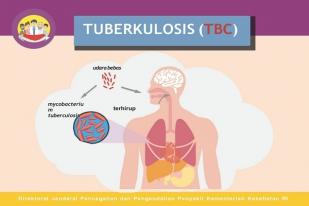 Kemkes: 15 Kematian Tiap Jam di Indonesia Akibat TBC