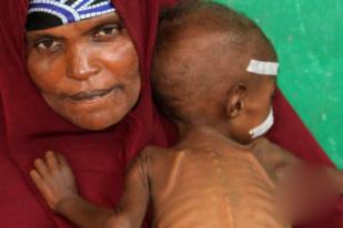 Campak Ancam Nyawa Ribuan Anak Somalia