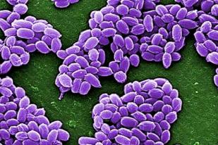 75 Ilmuwan AS Terpapar Bakteri Antraks