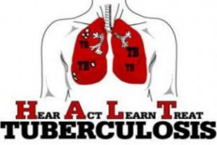 Obat Uji Coba Baru Persingkat Waktu Pengobatan Tuberkulosis