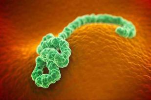 Apa itu Virus Ebola ?
