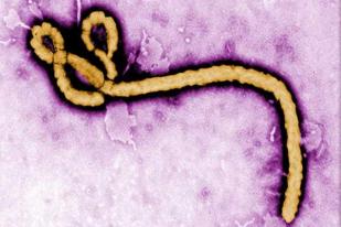 AS Konfirmasi Kasus Ebola Pertama 