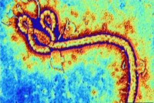 Uji Vaksin Ebola Dihentikan Sementara karena Nyeri Sendi