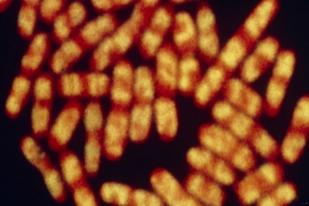 Bakteri Tifus di Asia dan Afrika Kebal Antibiotik