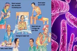 Kemenkes Tindaklanjuti Penanggulangan Tuberkolosis Pasca MDGs 2015