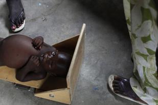 20 Persen Kematian Akibat Kolera di Sudan Selatan adalah Balita