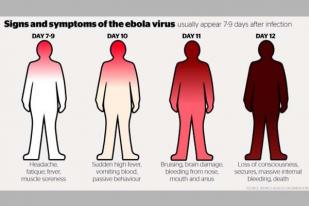 Peneliti AS Temukan Antibodi Ebola yang Efektif