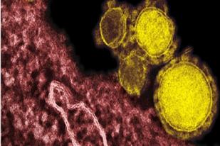 Korban Tewas Akibat Virus MERS Cov di Arab Saudi Mencapai 54 Orang