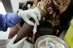 HIV Jenis Baru Lebih Cepat Berkembang Jadi AIDS