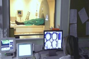 Deteksi Alzheimer Sejak Dini dengan MRI