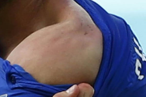 Luis Suarez Dituduh Gigit Lawan Lagi